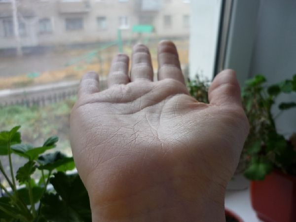 Запястье руки